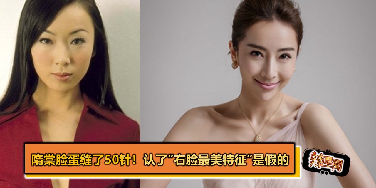 隋棠脸蛋缝了50针！　认了”右脸最美特征“是假的